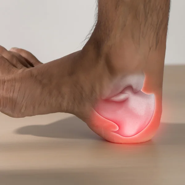 A person suffering from heel pain, with a visible red spot on the foot.