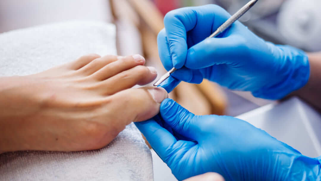 A close-up photograph showing a podiatrist or manicurist in blue nitrile gloves using a metal tool to push back the cuticle on a patient's big toe during a professional pedicure or foot care treatment.